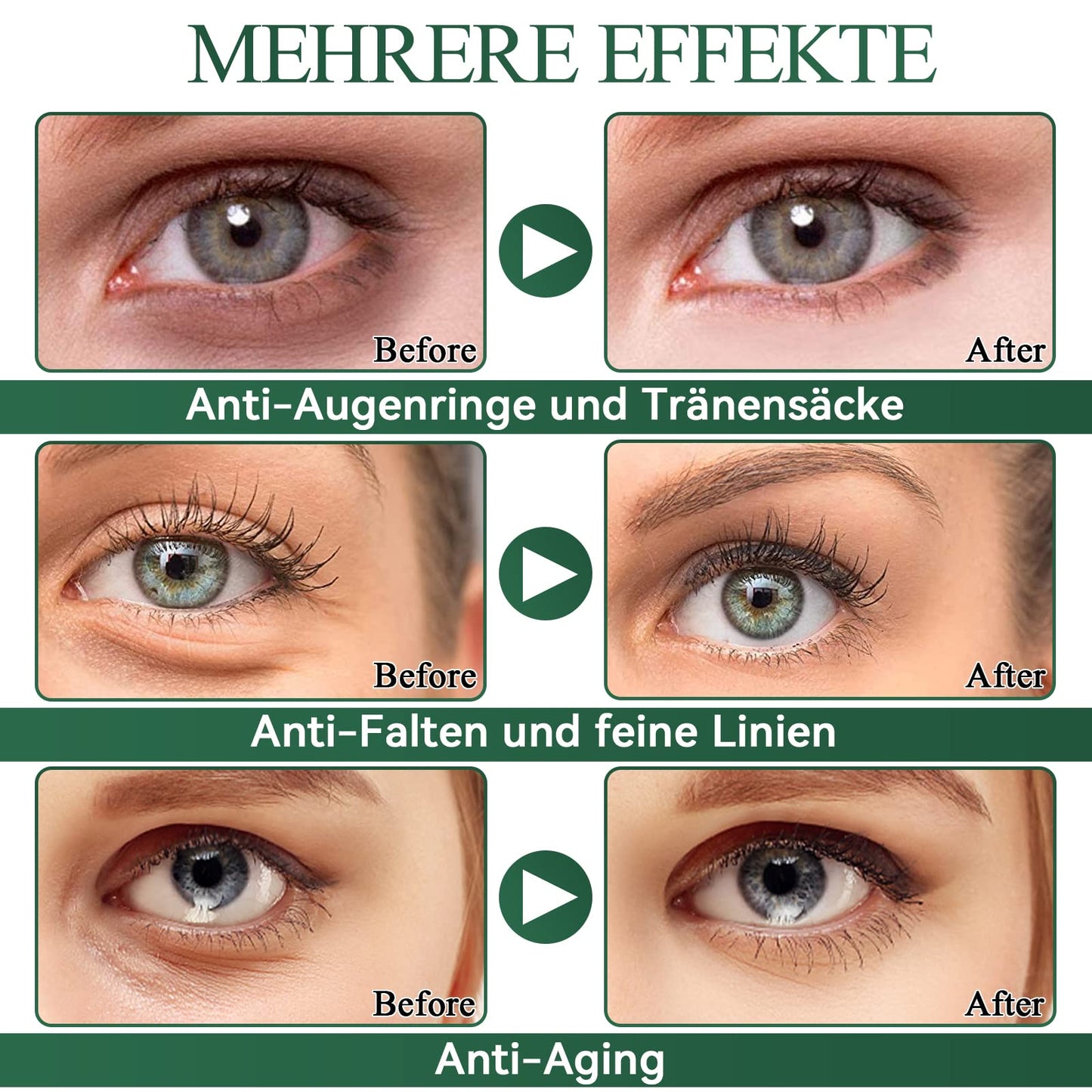 Eveellyn Augenpads, 60Pcs Augenpads Gegen Augenringe, Aloe Vera Eye Pads, Hyaluronsäure Augenmaske Augenringe Entfernen, Gegen Falten,Tränensäcke, Puffiness