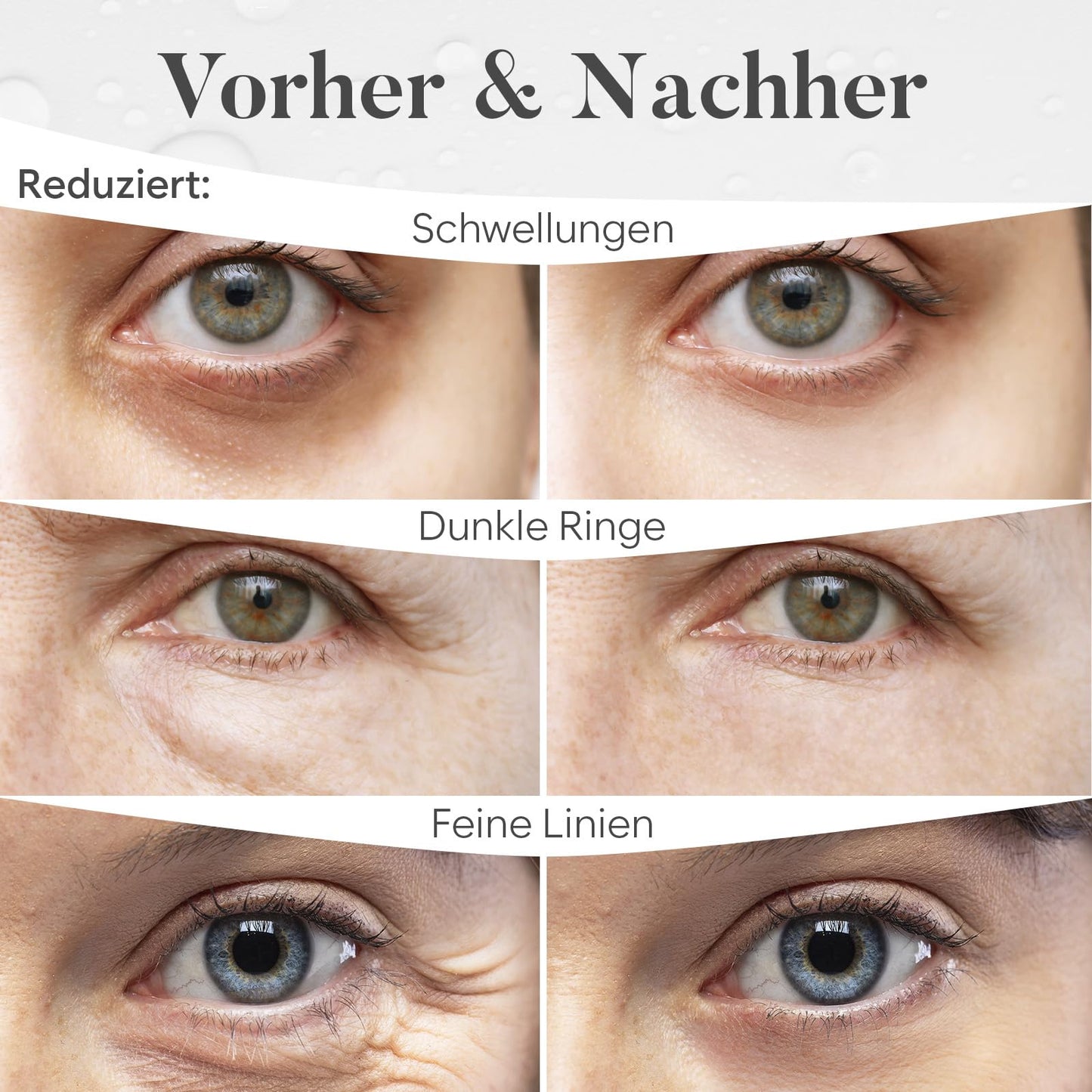 BLOOMORA Gemischte Augenpads (30 Paare) | Eye Pads mit Niacinamid & Augenpads Hyaluron | Augenpads Gegen Augenringe | Augenringe Entfernen | Eye Patches